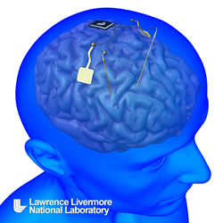 Implantable brain stimulator for mental disorders